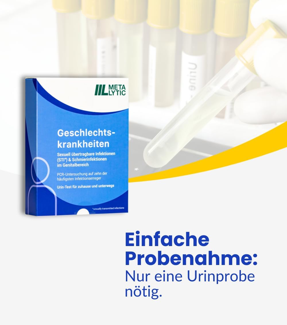 Express XXL STI-Test „10-in-1“ für sexuell übertragbare Krankheiten im Deutschen Qualitätslabor, Urintest – Bild 3