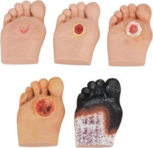 Diabetiker-Fußmodell für Wundvers...