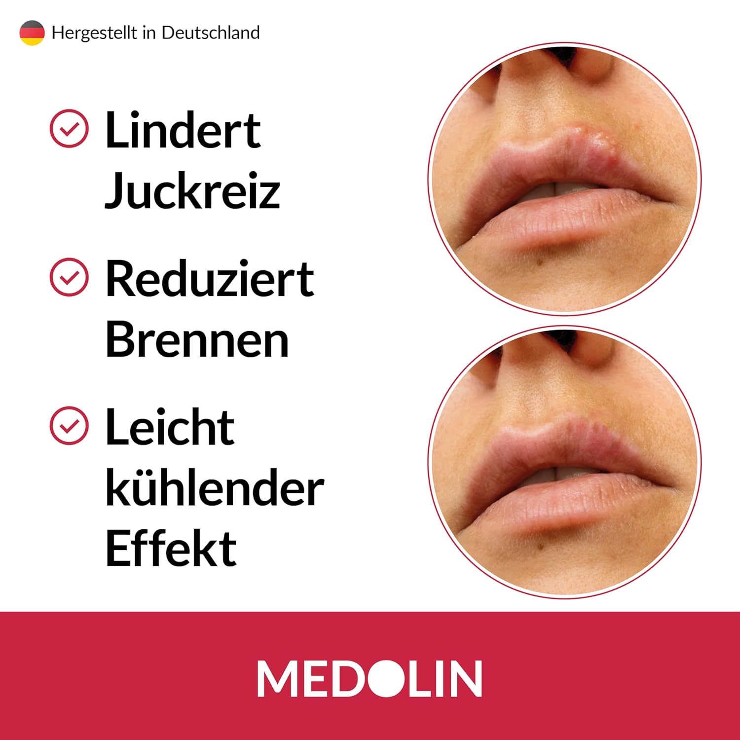 Medolin Herpes-Gel – Herpes-Creme gegen Fieberbläschen – wissenschaftlich bestätigte Wirkung – dermatologisch getestete Herpes-Salbe für gesunde Lippen – Lippenherpes-Creme, 8 ml – Bild 3