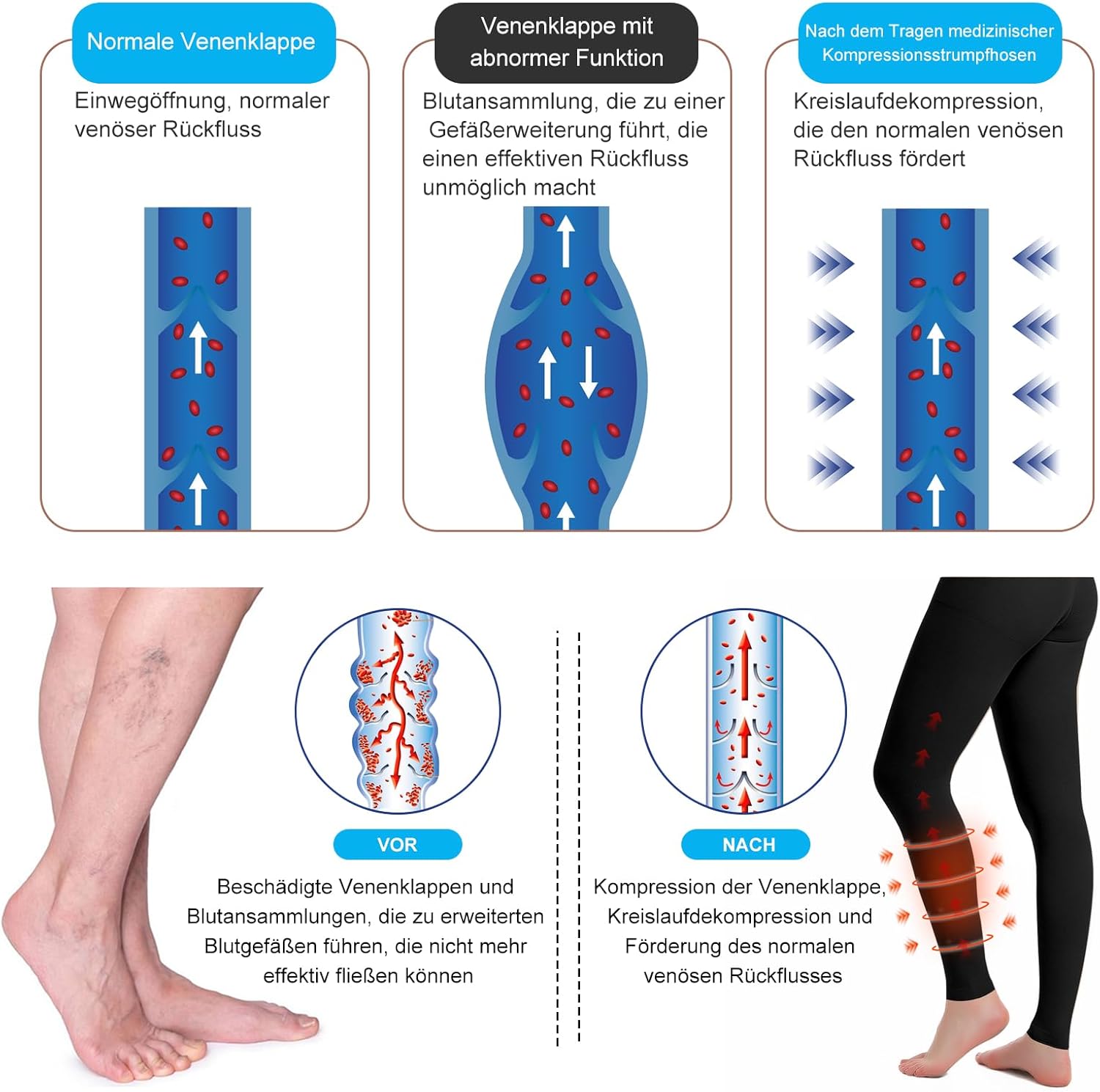 Medizinische Kompressionsstrümpfe für Damen und Herren, 20–30 mmHg, progressive Stützstrumpfhose, blickdichte, zehenfreie Kompressionshose, Klasse 2, geeignet für Krampfaderödeme, TVT – Bild 3