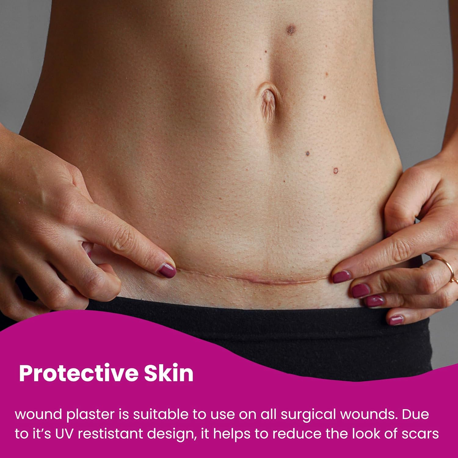 Protective Skin 5 x 25 cm Silikon-Wundverband für Kaiserschnitte & chirurgische Schnitte, atmungsaktiv, selbstklebend, hautfreundlich, langlebig, 10 Stück – Bild 3